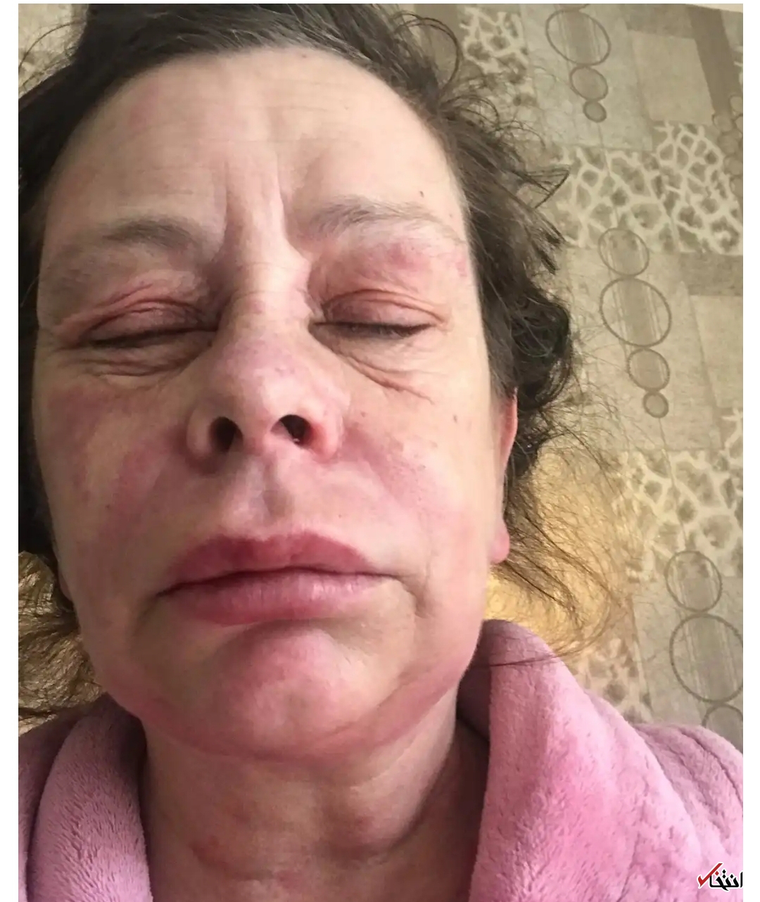 شکایت یک زن انگلیسی 