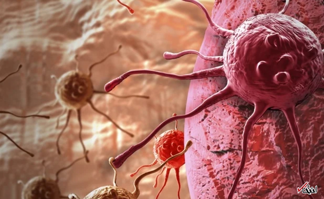 آمادگی ربات&zwnj;ها برای جراحی مبتلایان به سرطان