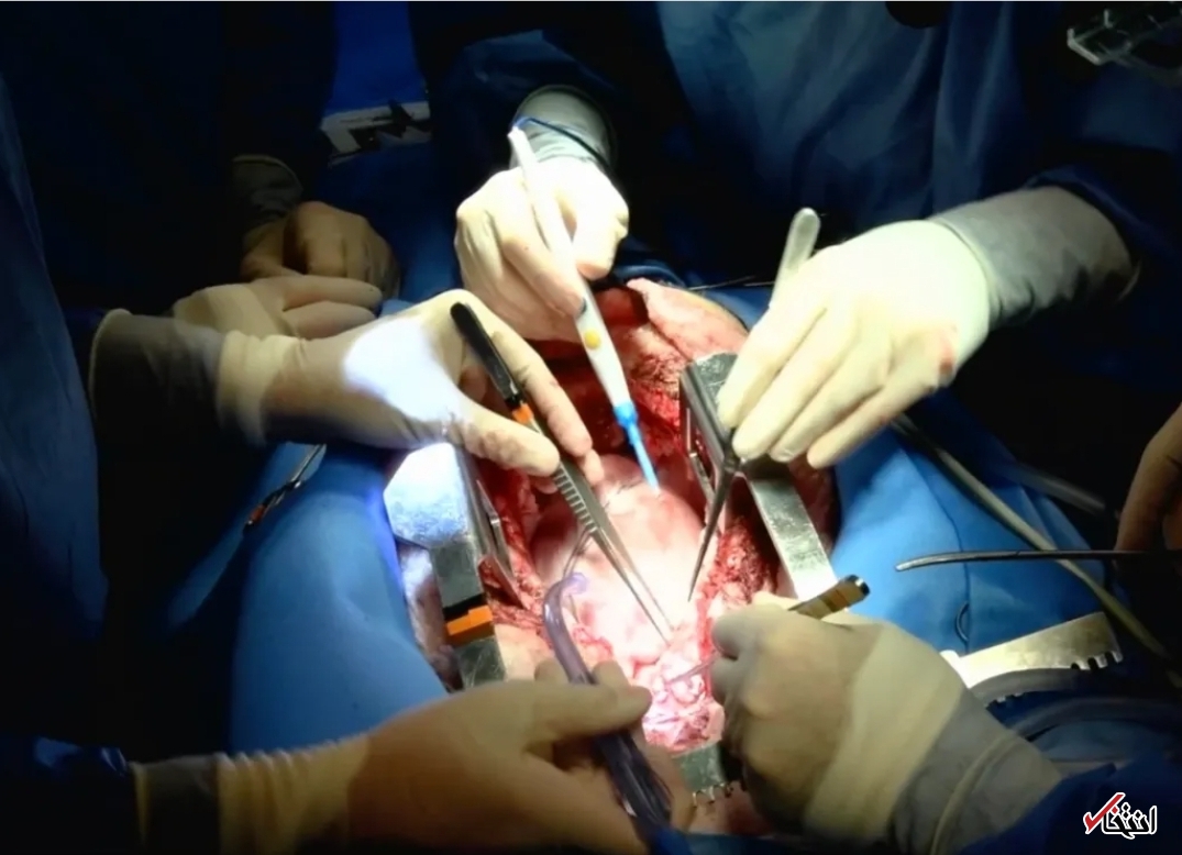 رمز موفقیت پیوند قلب خوک به انسان کوکائین بود؟