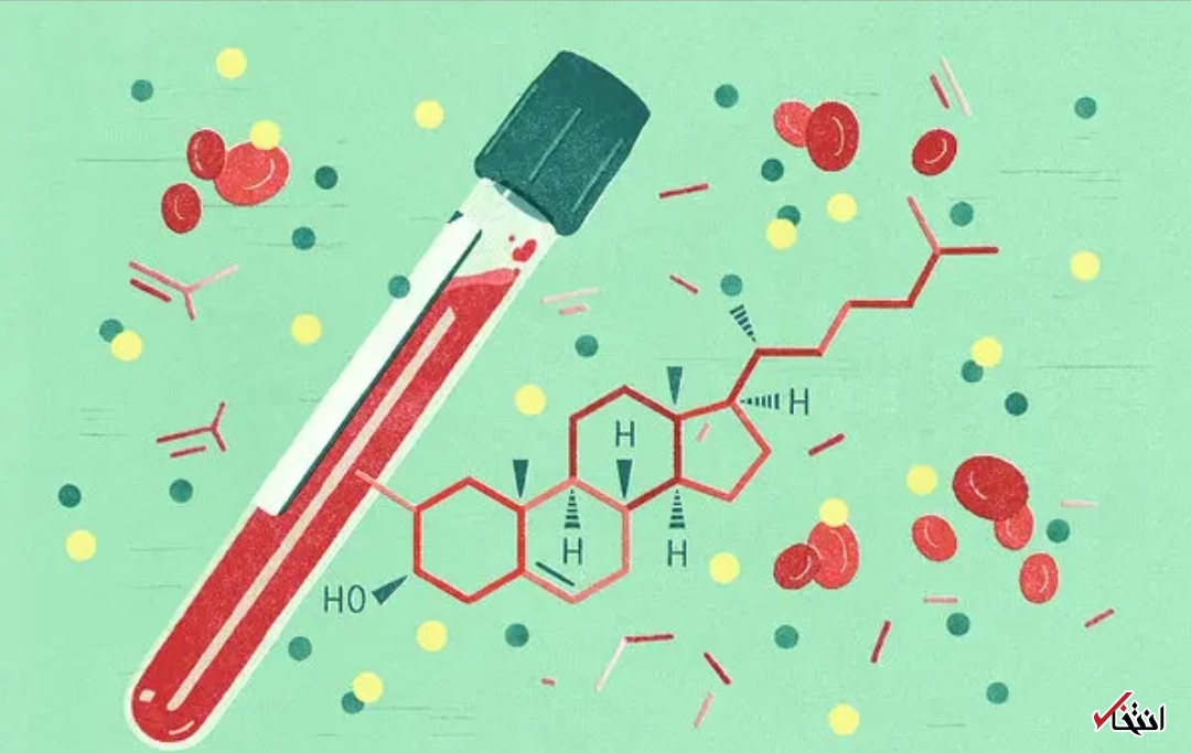 کلسترول بالا 