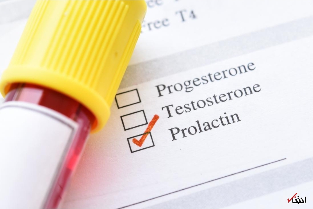 پرولاکتین